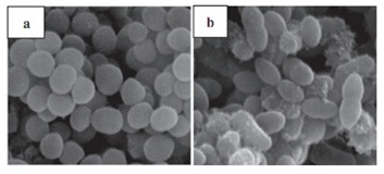 纯化的G型溶菌酶处理后溶壁微球菌的扫描电镜观察